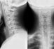 https://www.osteo-osteopathe-osteopathie-paris.fr/Osteopathie-Traitement-des-Cervicalgies-et-Osteopathie_a38.html